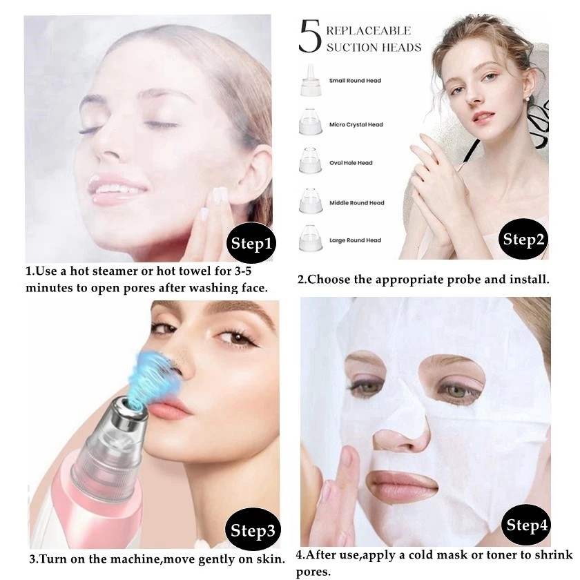 Blackhead Cleansing Device: 5 Nozzles for Full Face, 3 Suction Levels for Targeted Cleansing
