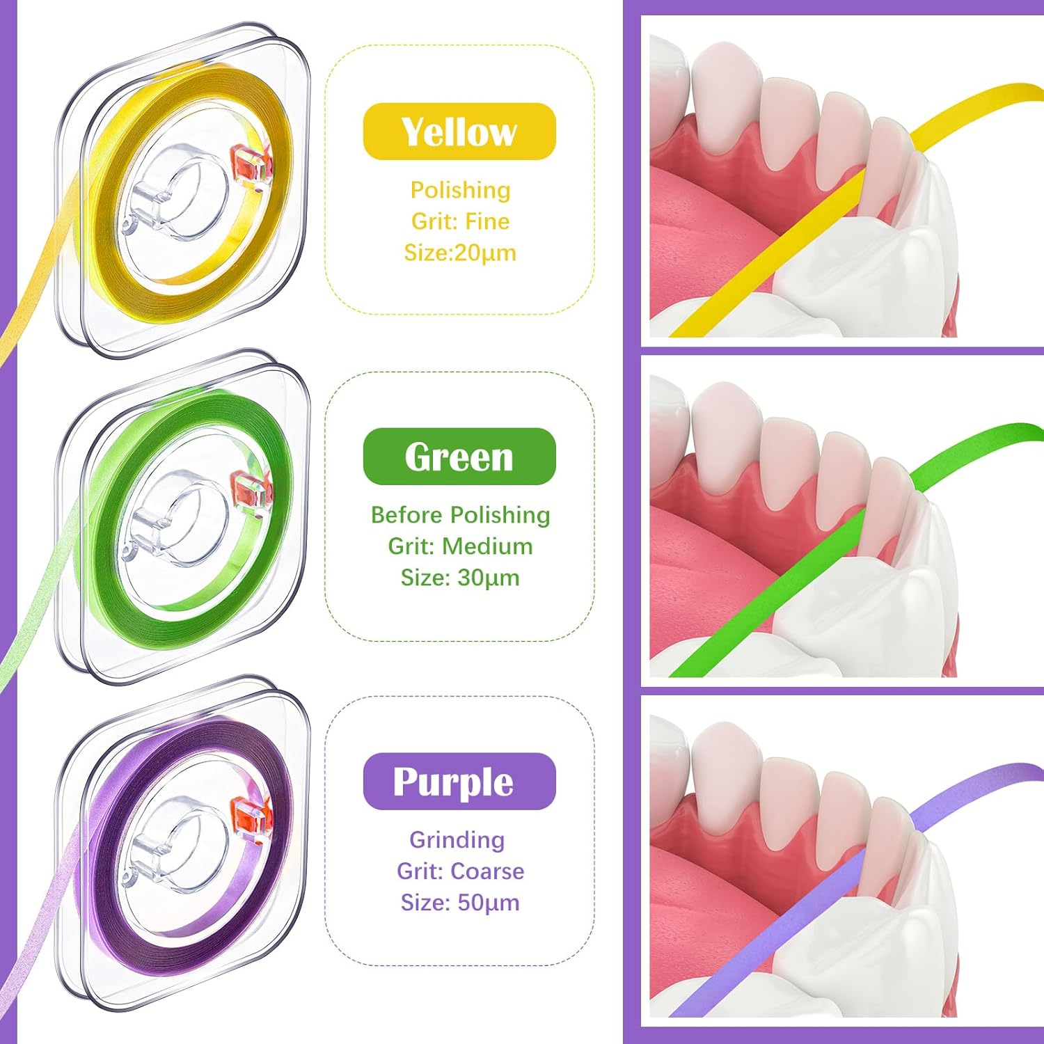 Amylove Dental Polishing Strips Tooth File 3 Rolls 4mm x 600mm Dental Polisher Teeth Sanding Grinding Deep Teeth Cleaning Tool Tooth Polish Abrasive Strip Oral Care(Coarse, Fine, Medium,Multi Color)