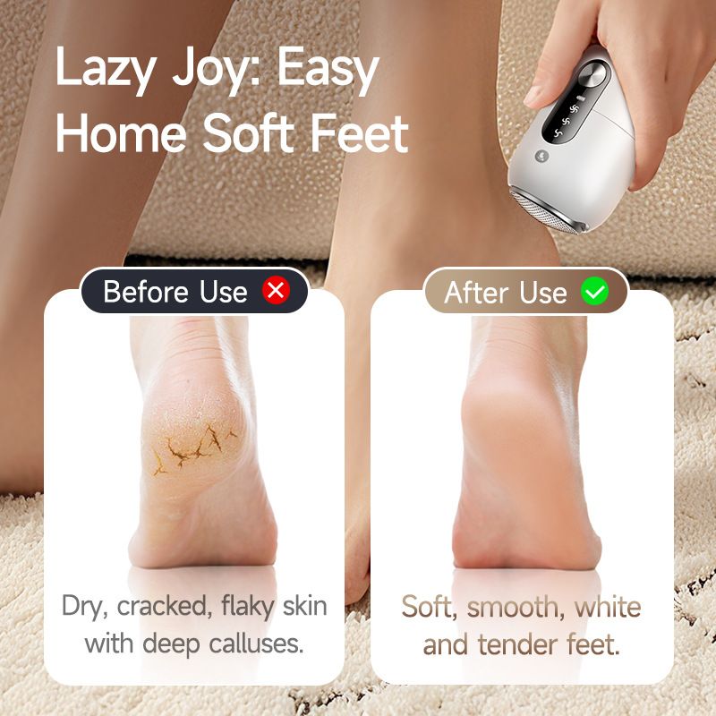 Smart Electric Foot File, 26000Pa Suction, Smooth in 3 Seconds, IPX6 Waterproof, Portable Foot Care/white