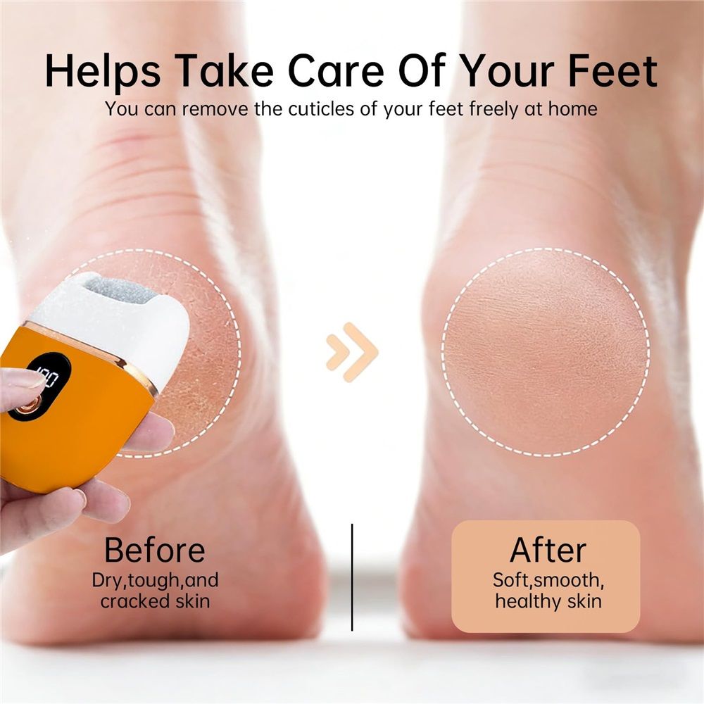 Electric Foot Callus Removers for Feet - Rechargeable et, Portable Rechargeable Foot Repair and Grinding Device with Digital Display, Heel Polisher File for Men Women Dry Callus Dead Skin (Yellow)
